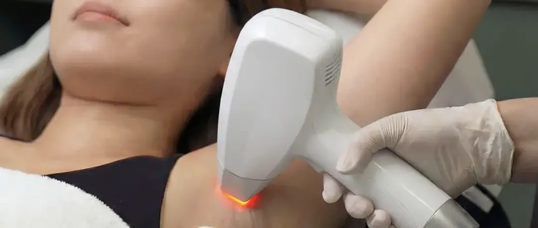 Épilation Laser Packages